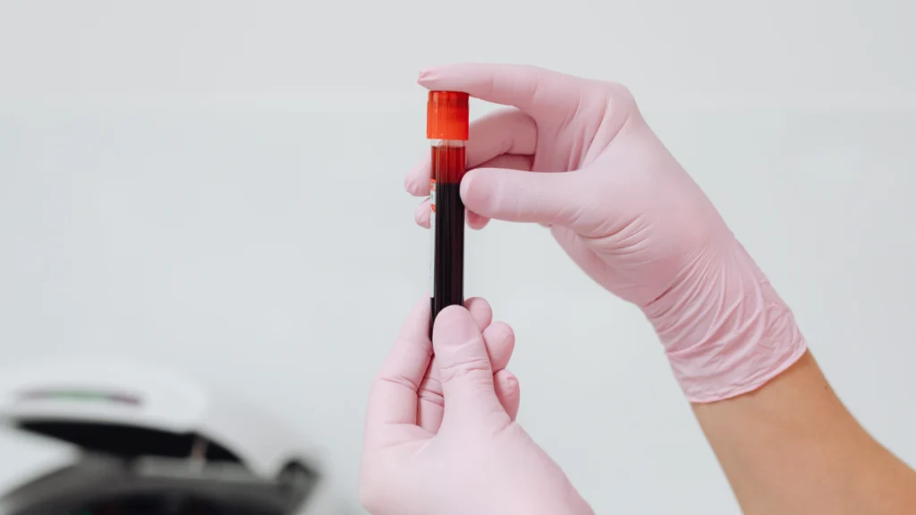 Cholesterol nie boli. To właśnie dlatego tak łatwo go przegapić próbka krwi